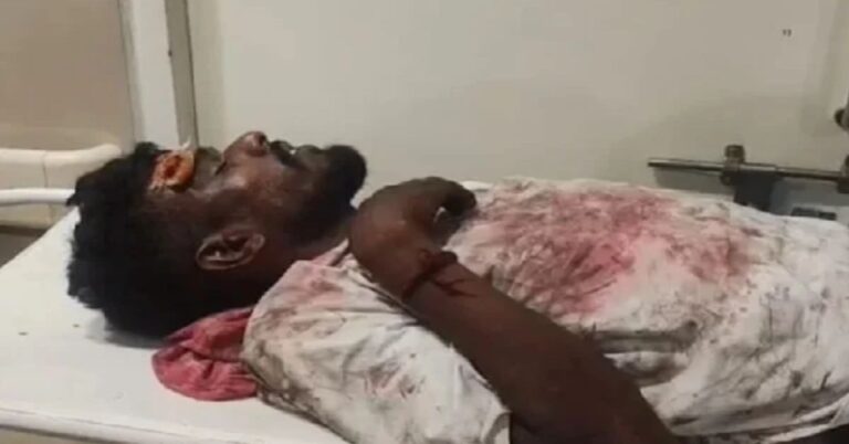 जमशेदपुर के जेम्को बाजार में युवक पर जानलेवा हमला, 20 से 25 लोगों ने धारदार हथियार से किया वार